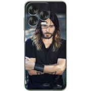 Чохол BoxFace Nubia V70 Design 
