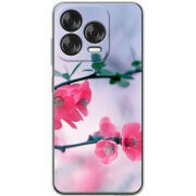 Чохол BoxFace Nubia V70 Design 