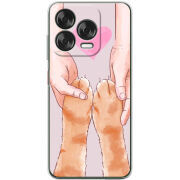Чохол BoxFace Nubia V70 Design 