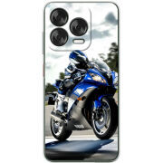 Чохол BoxFace Nubia V70 Design 