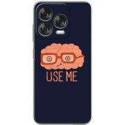 Чохол BoxFace Nubia V70 Design 