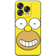 Чохол BoxFace Nubia V70 Design 