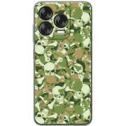 Чохол BoxFace Nubia V70 Design 
