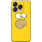 Чохол BoxFace Nubia V70 Design 