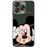 Прозорий чохол BoxFace Nubia V70 Design Mister M