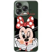 Прозорий чохол BoxFace Nubia V70 Design Lady M
