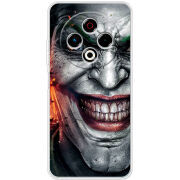 Чохол BoxFace Tecno Spark 30 4G Prankster