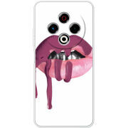 Чохол BoxFace Tecno Spark 30 4G 