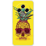 Чохол BoxFace Tecno Spark 30 4G Pineapple Skull