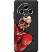 Чорний чохол BoxFace Tecno Spark 30 4G Титан