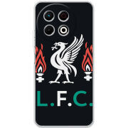 Чохол BoxFace Tecno Spark 30 Pro 4G L. F. C.