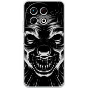 Чохол BoxFace Tecno Spark 30 Pro 4G 
