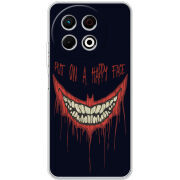 Чохол BoxFace Tecno Spark 30 Pro 4G 