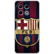 Чохол BoxFace Tecno Spark 30 Pro 4G 