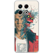 Чохол BoxFace Tecno Spark 30 Pro 4G 