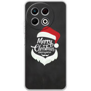 Чохол BoxFace Tecno Spark 30 Pro 4G 