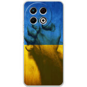 Чохол BoxFace Tecno Spark 30 Pro 4G Handshake