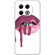 Чохол BoxFace Tecno Spark 30 Pro 4G 