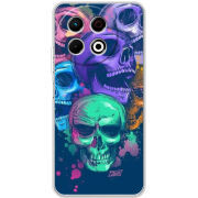 Чохол BoxFace Tecno Spark 30 Pro 4G 