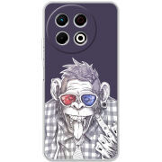 Чохол BoxFace Tecno Spark 30 Pro 4G 