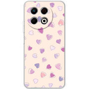 Чохол BoxFace Tecno Spark 30 Pro 4G 