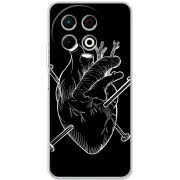 Чохол BoxFace Tecno Spark 30 Pro 4G 