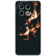 Чохол BoxFace Tecno Spark 30 Pro 4G 