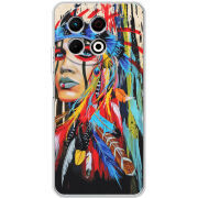 Чохол BoxFace Tecno Spark 30 Pro 4G 