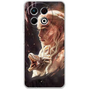 Чохол BoxFace Tecno Spark 30 Pro 4G 