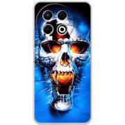 Чохол BoxFace Tecno Spark 30 Pro 4G 