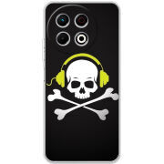 Чохол BoxFace Tecno Spark 30 Pro 4G 