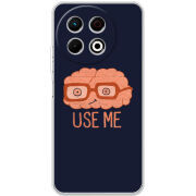 Чохол BoxFace Tecno Spark 30 Pro 4G 