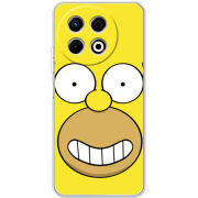 Чохол BoxFace Tecno Spark 30 Pro 4G 