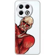 Прозорий чохол BoxFace Tecno Spark 30 Pro 4G Титан