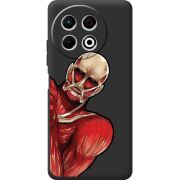 Чорний чохол BoxFace Tecno Spark 30 Pro 4G Титан