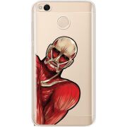 Прозрачный чехол Uprint Xiaomi Redmi 4x Титан