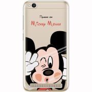 Прозрачный чехол Uprint Xiaomi Redmi 5A Mister M