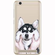 Прозрачный чехол Uprint Xiaomi Redmi 5A Husky