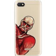 Прозрачный чехол Uprint Xiaomi Redmi 6A Титан