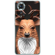 Чохол BoxFace Honor 50 