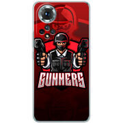 Чохол BoxFace Honor 50 