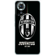 Чохол BoxFace Honor 50 