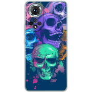 Чохол BoxFace Honor 50 