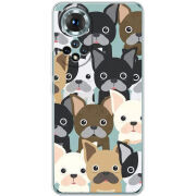 Чохол BoxFace Honor 50 