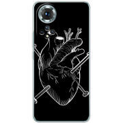 Чохол BoxFace Honor 50 