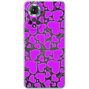 Чохол BoxFace Honor 50 