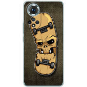 Чохол BoxFace Honor 50 