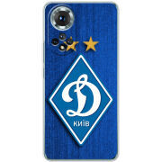 Чохол BoxFace Honor 50 Динамо Киев