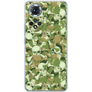 Чохол BoxFace Honor 50 