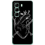 Чохол BoxFace Infinix Hot 50 Pro Plus 